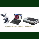 點(diǎn)擊查看 HiCC-Z組合型全自動(dòng)菌落計(jì)數(shù)、抑菌圈測(cè)量、β-內(nèi)酰胺酶檢測(cè)、顯微分析儀系統(tǒng) 詳細(xì)